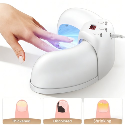 Anti fungal laser nail therapy - laser,